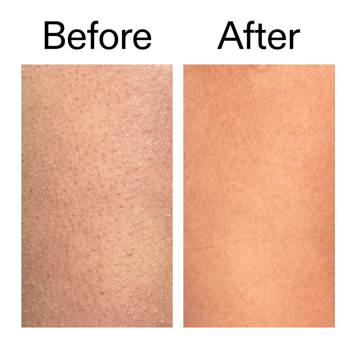 glycolic-acid-exfoliating-body-stick-j7 Glycolic_Body_Stick_B_A_2000x2000_6e6e6b4d-5bd7-43c0-aeed-4d66788e8995.jpg
