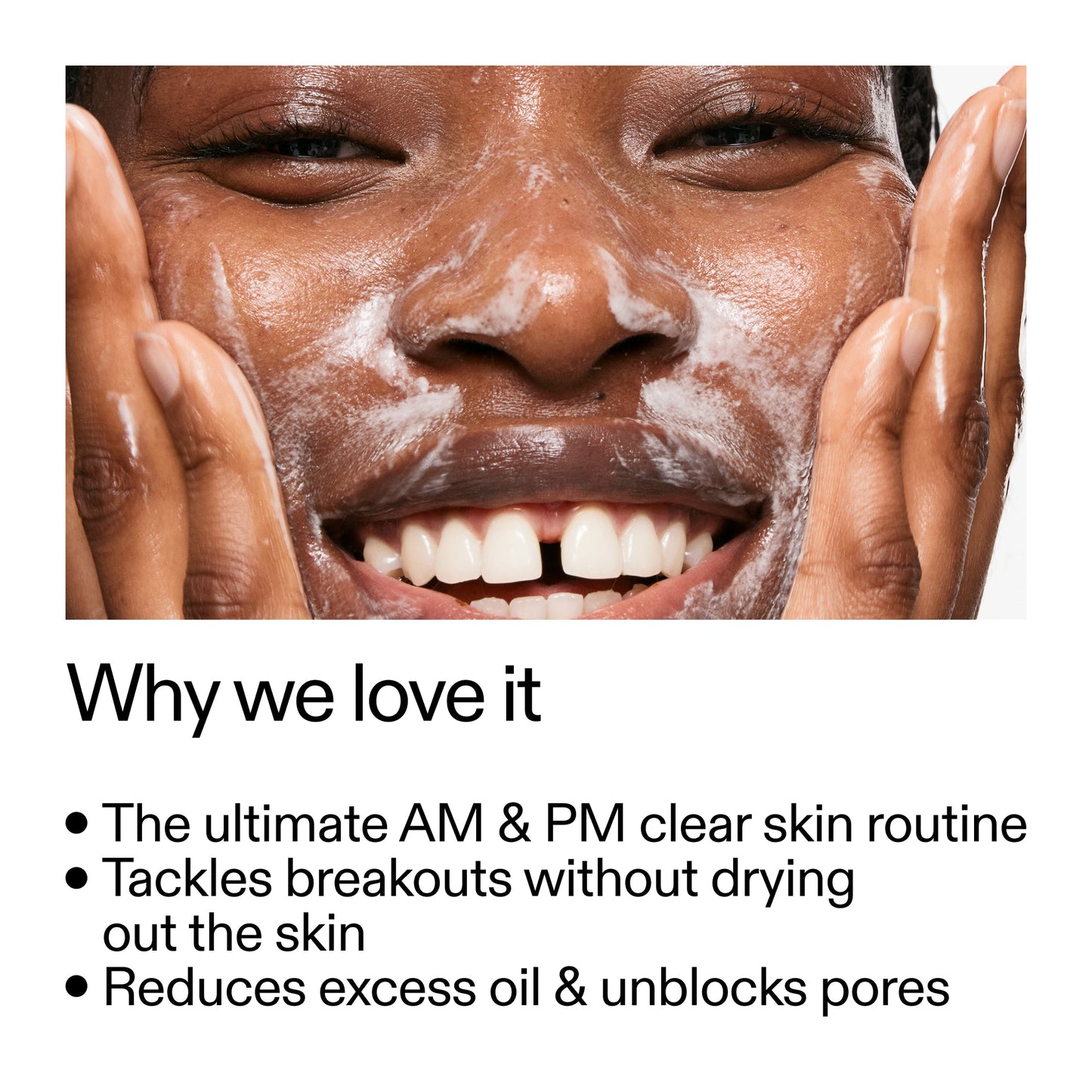intro-routine-for-acne-o9 Intro_Routine_for_Acne_Why_we_love_it_2000x2000_42499e10-4629-4a0e-a627-7e215f4da6bc.jpg
