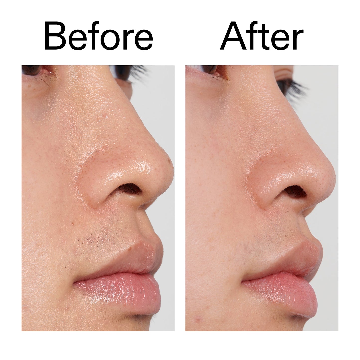 pha-toner-l0 PHA_Toner_Before_After_2000x2000_e3c10172-0150-4342-8b95-57417eaff50d.jpg