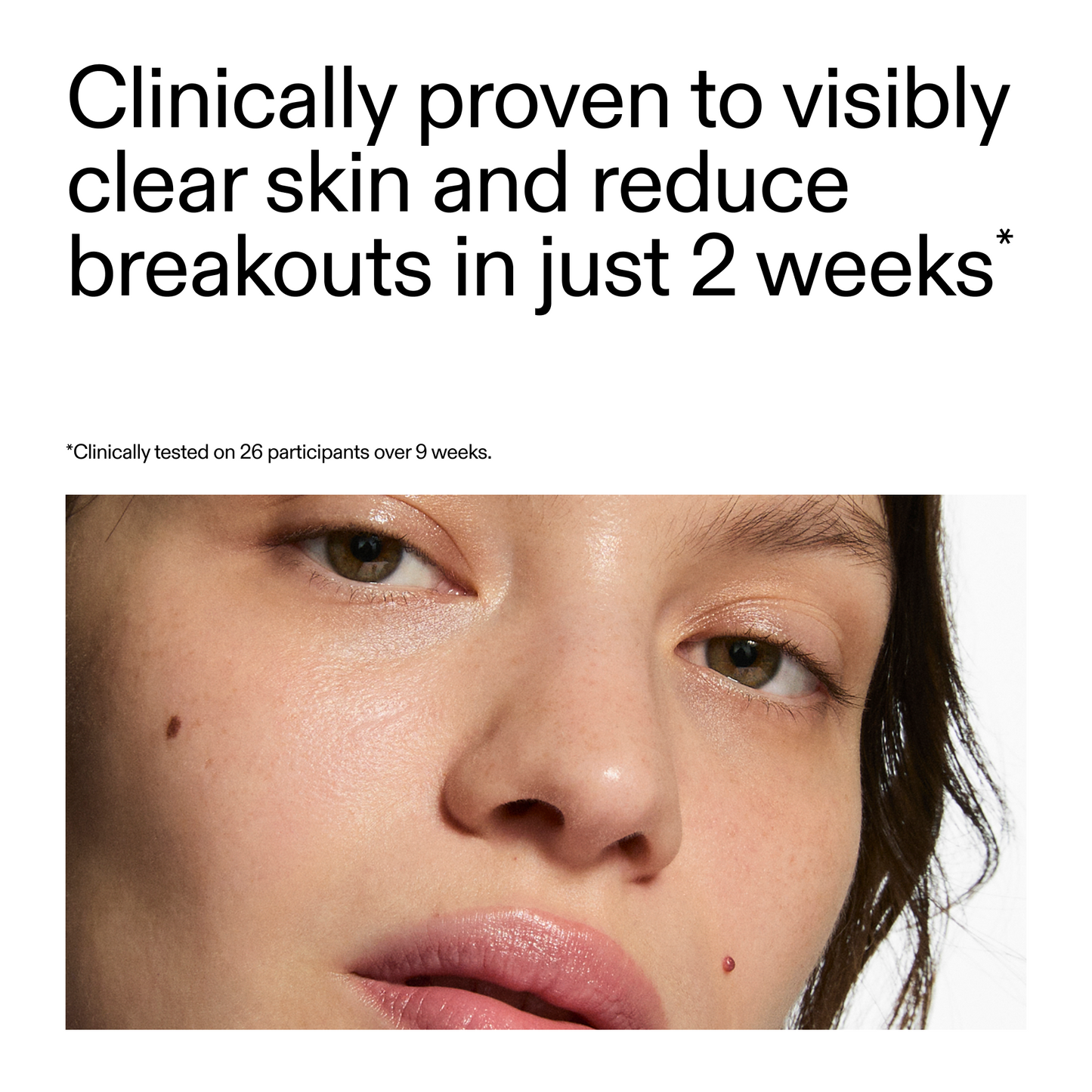 360-acne-clearing-duo-y6 360_Serum_Key_Claim.png