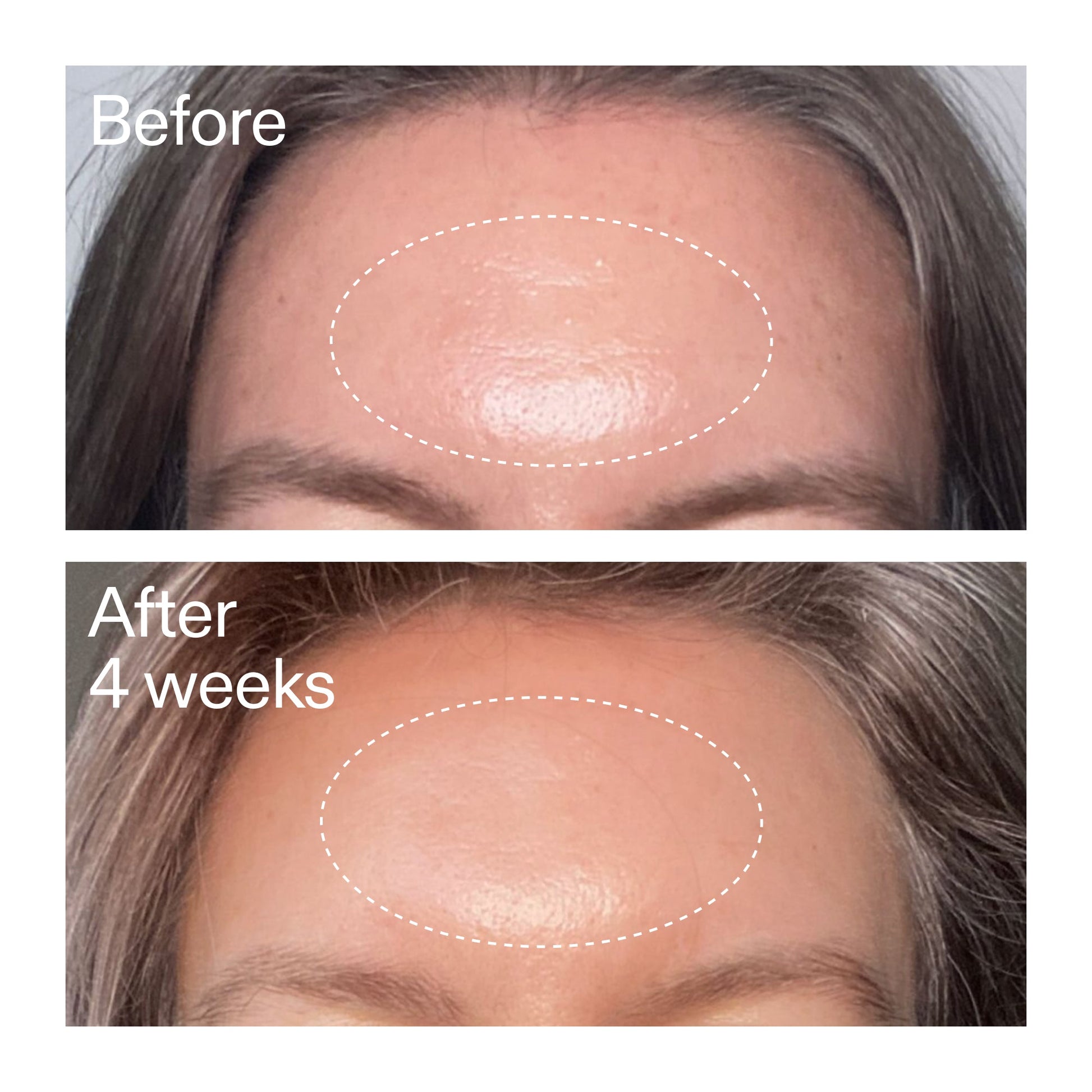 advanced-0-2-retinal-serum-duo-f2 AdvancedRetinal_BeforeAfter1_2000x2000_4e9c798a-f30e-45b8-a34a-7c4740f2f2cb.jpg