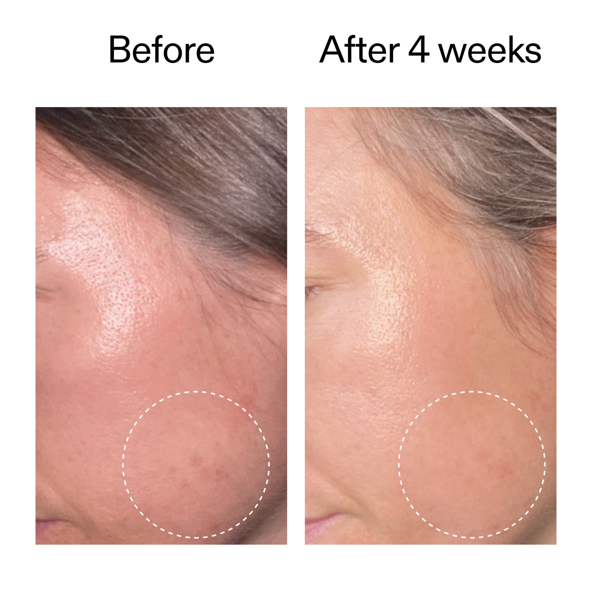 advanced-0-2-retinal-serum-o1 AdvancedRetinal_BeforeAfter2__2000x2000_62fb16bb-77ae-4d63-8500-88dbf847f4b9.jpg