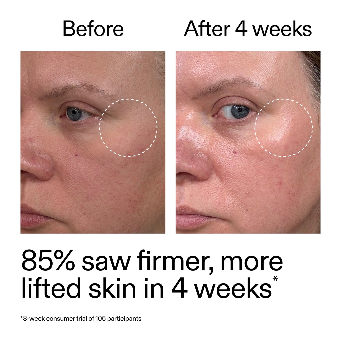 advanced-0-2-retinal-serum-duo-f2 AdvancedRetinal_BeforeAfter_Claim1_2000x2000_3a315aa8-f408-4b33-bbeb-0d9209f98404.jpg