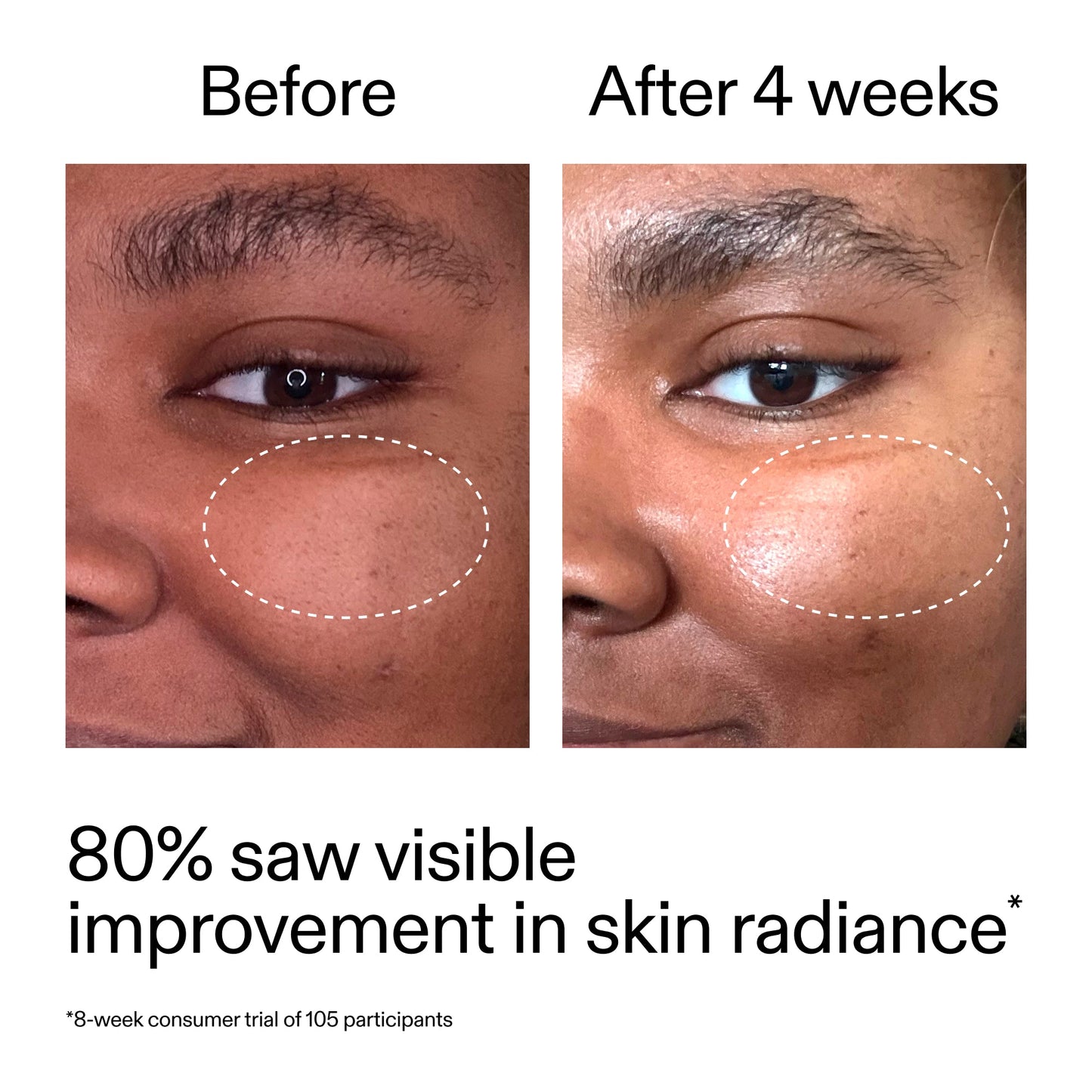 advanced-0-2-retinal-serum-o1 AdvancedRetinal_BeforeAfter_Claim2_2000x2000_39d11e3d-eda9-44ec-ab32-2903b1a368bd.jpg