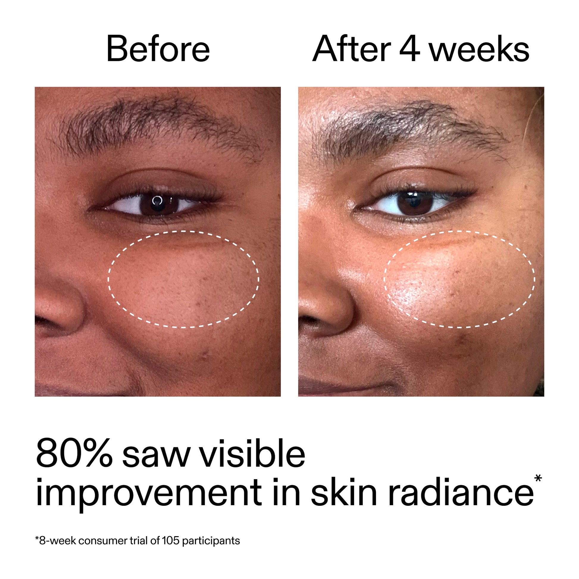 advanced-0-2-retinal-serum-duo-f2 AdvancedRetinal_BeforeAfter_Claim2_2000x2000_681b621d-8d44-4d44-9a40-89244f9b2e53.jpg