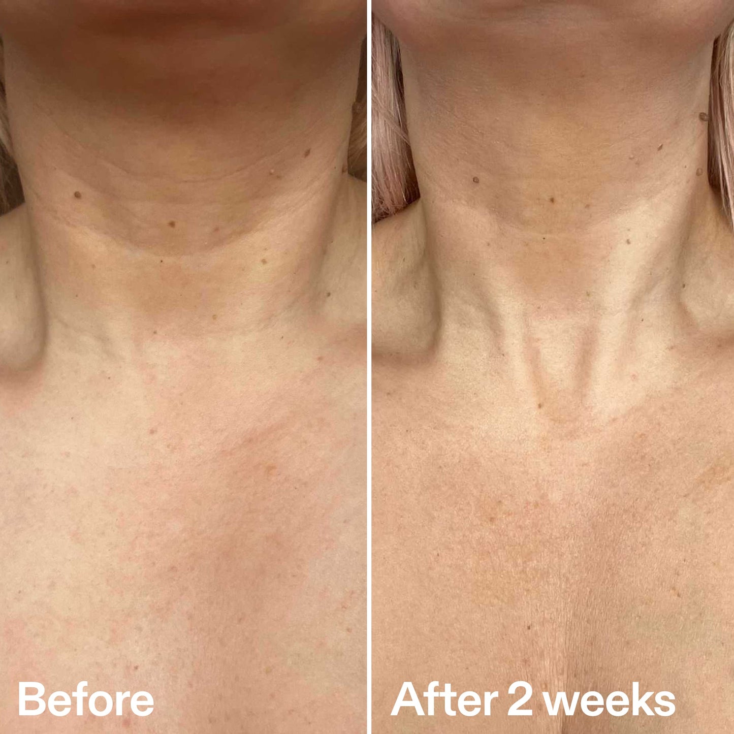 bio-active-neck-lift-stick-m8 B_A_2.jpg