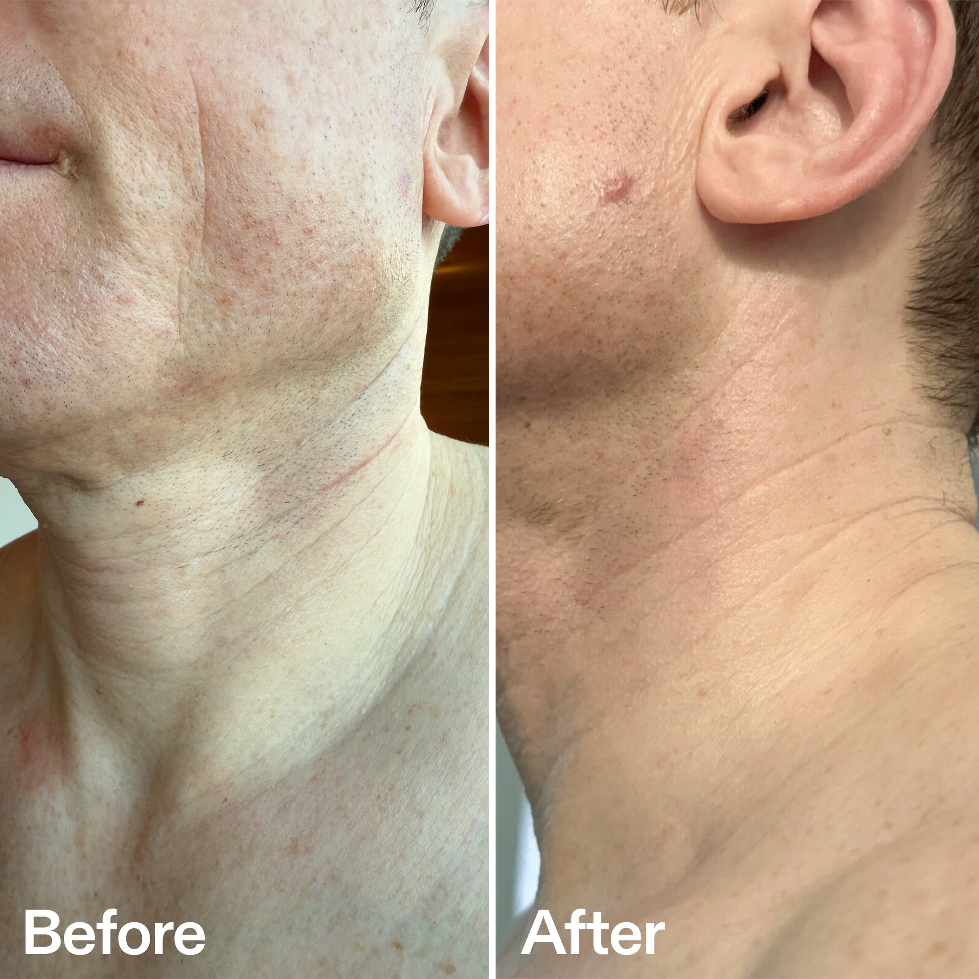 bio-active-neck-lift-stick-m8 B_A_afa2743e-b8e2-4504-92f4-e281cb6cf759.jpg