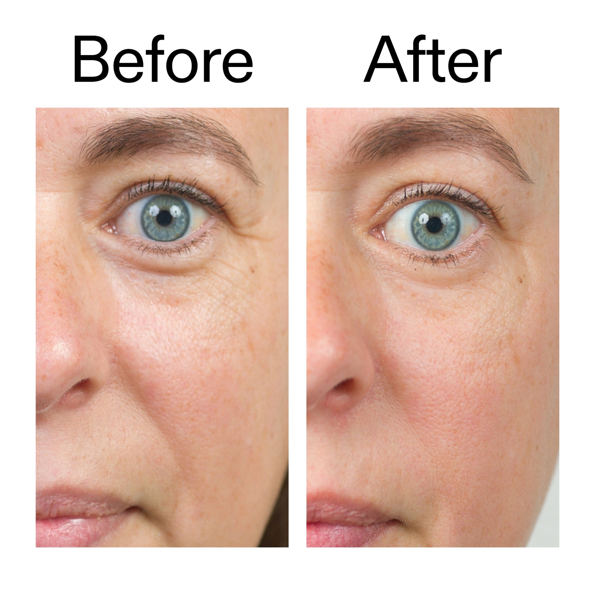 bio-active-ceramide-moisturizer-h4 Bio-Active_Before_After_2000x2000_566e5a9e-135e-417a-8242-b44e5fa35463.jpg