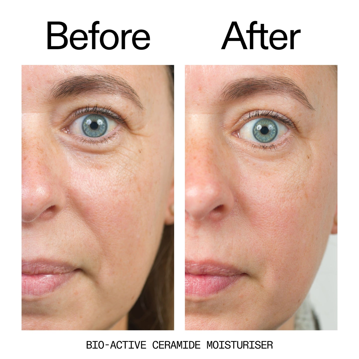 barrier-boosting-trio-e8 Bio-Active_Before_After_2000x2000_600947b4-e8c5-425a-9155-fc15bc83aa12.jpg