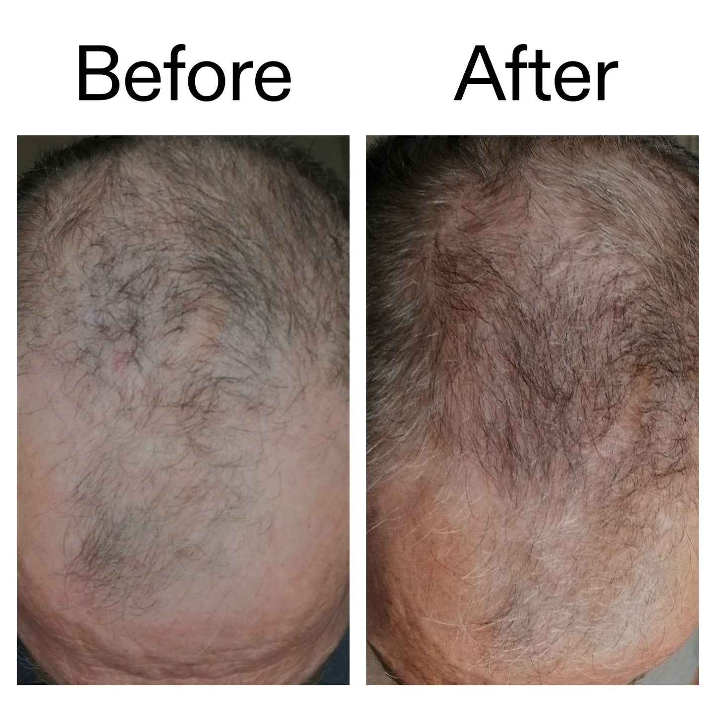 3-month-hair-growth-trio-v5 Caffeine_Scalp_Treatment_B_A_Ppage_2000_x_2000.jpg