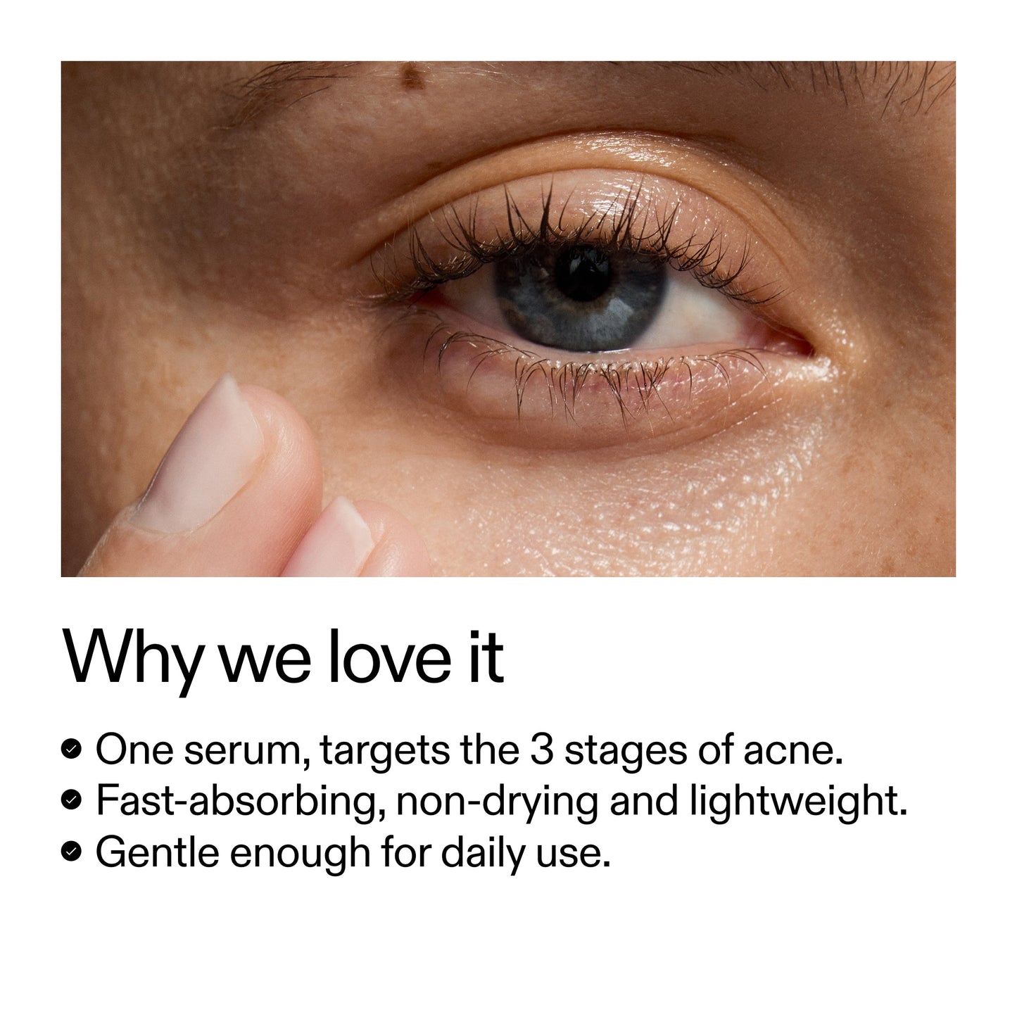 360-acne-clearing-duo-y6 Dioic_Whyweloveit_2000x2000_175aafd3-0cbe-403a-b317-a8362881bfe2.jpg