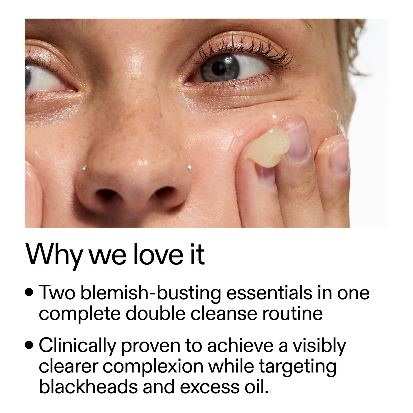 acne-double-cleanse-duo-x3 Double_Cleanse_Duo_for_Breakouts_Why_We_2000x2000_f242cb12-bb5c-487c-b203-071ccb406ec5.png