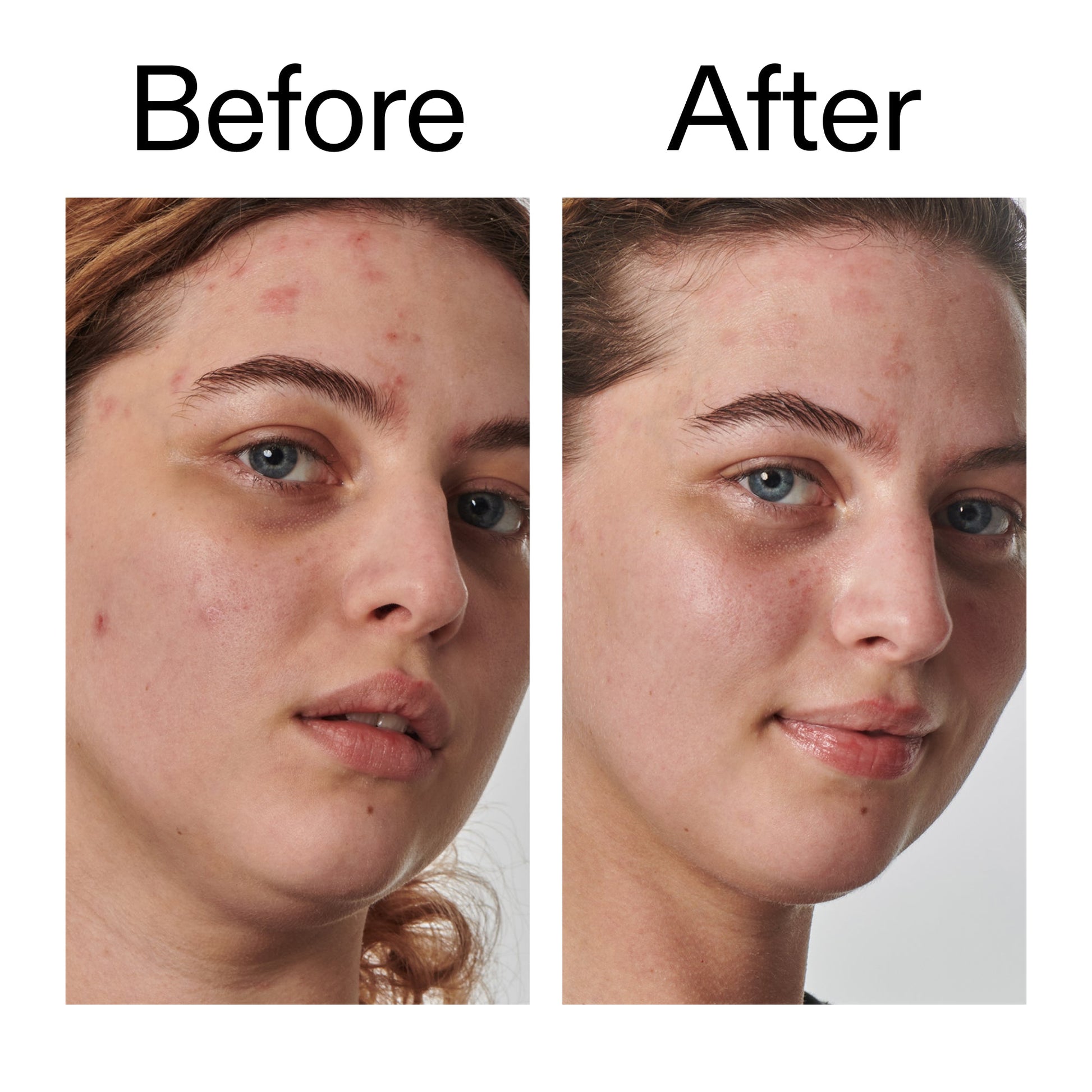 10-urea-moisturizer-p7 Dry_and_Rough_Skin_Solution_Before_After_2000x2000_efa6e639-5c39-49bd-a5dd-f0220293120a.jpg