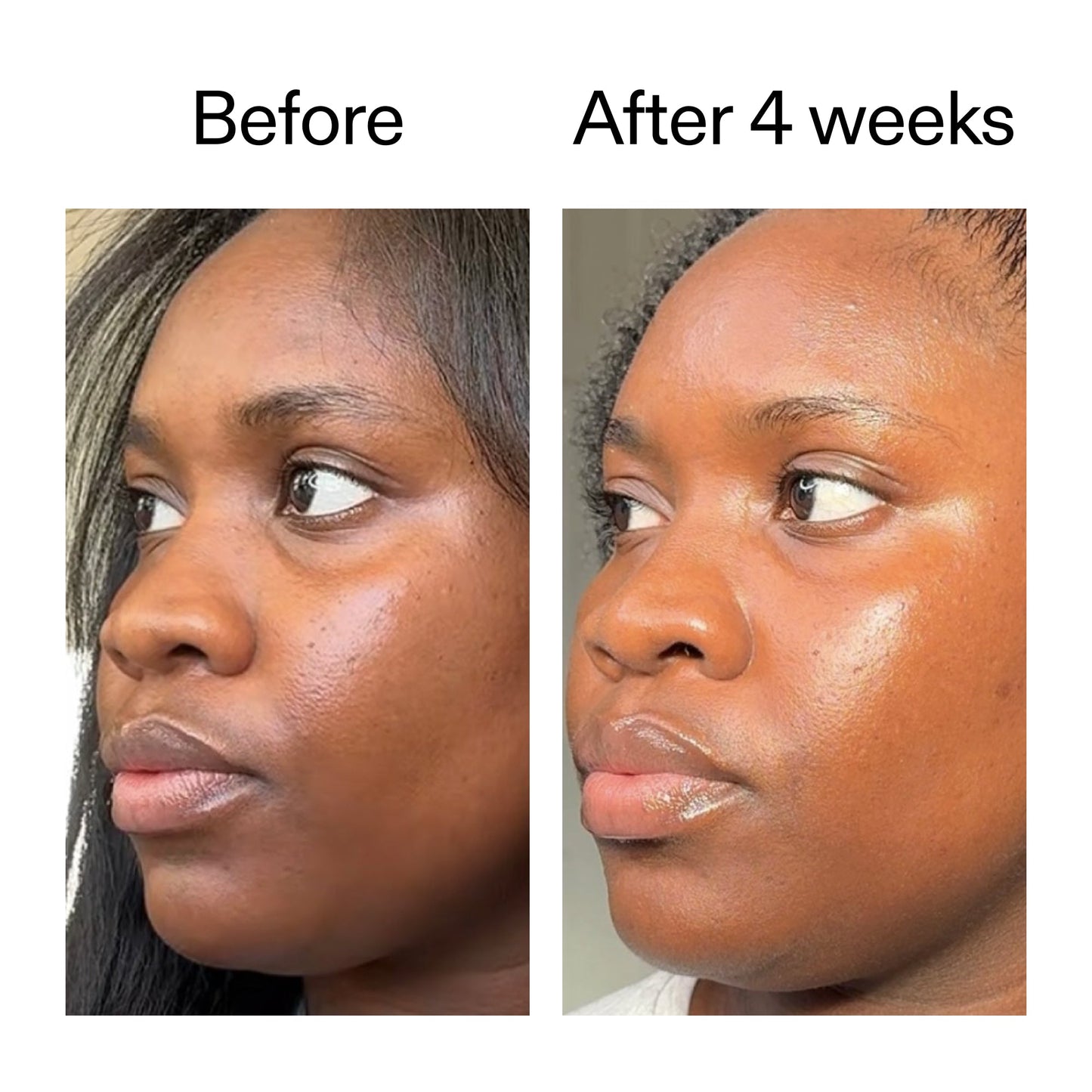 exosome-hydro-glow-complex-duo-a1 Exosome_Before_After_V12_2000x2000_2e7d50e1-0ed9-4624-91c6-1f94c0266a04.jpg