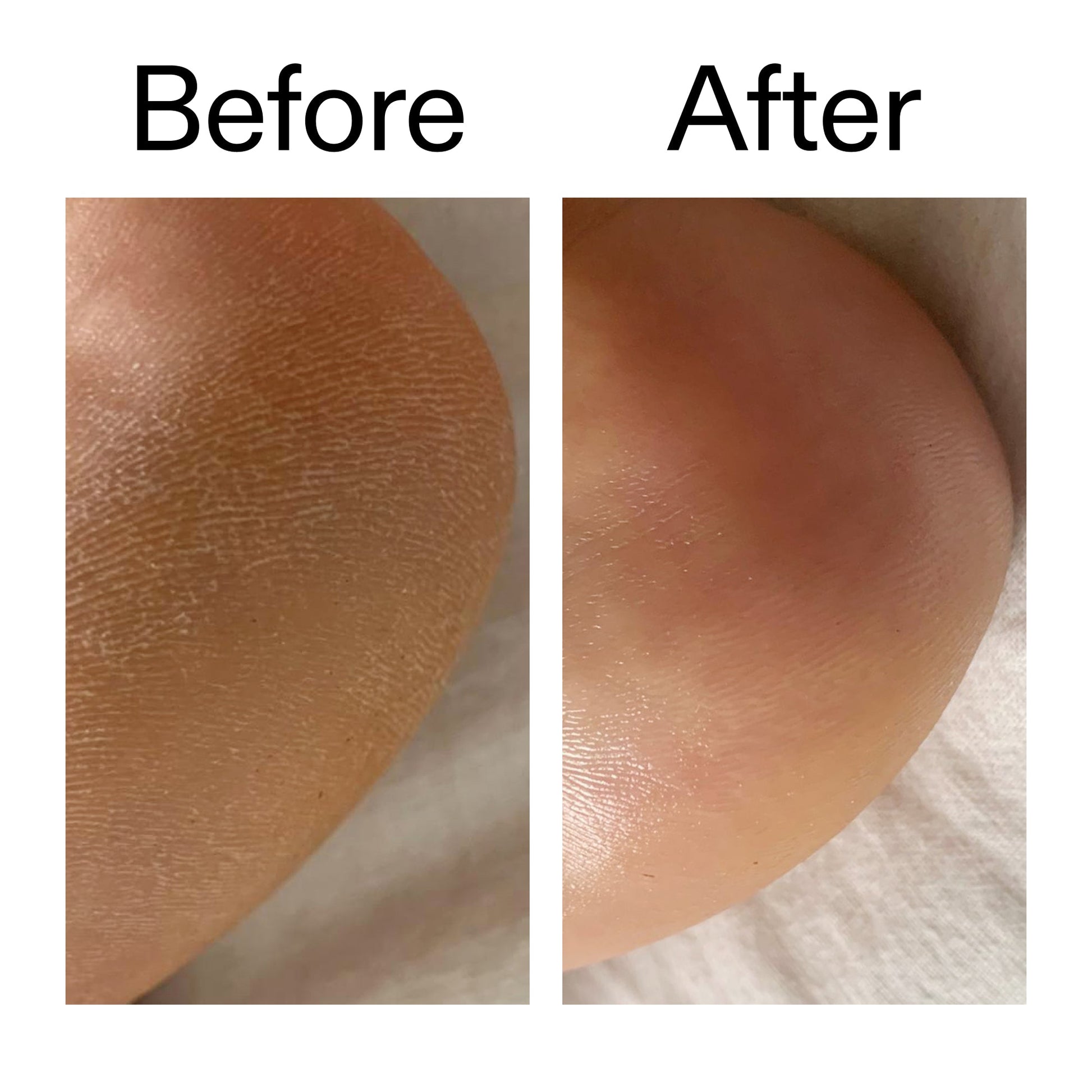 glycolic-acid-exfoliating-body-stick-j7 Glycolic_Acid_Exfoliating_Body_Stick_Before_After_V1_2000x2000_a3043625-9400-429a-a7fb-d6dbd220f722.jpg
