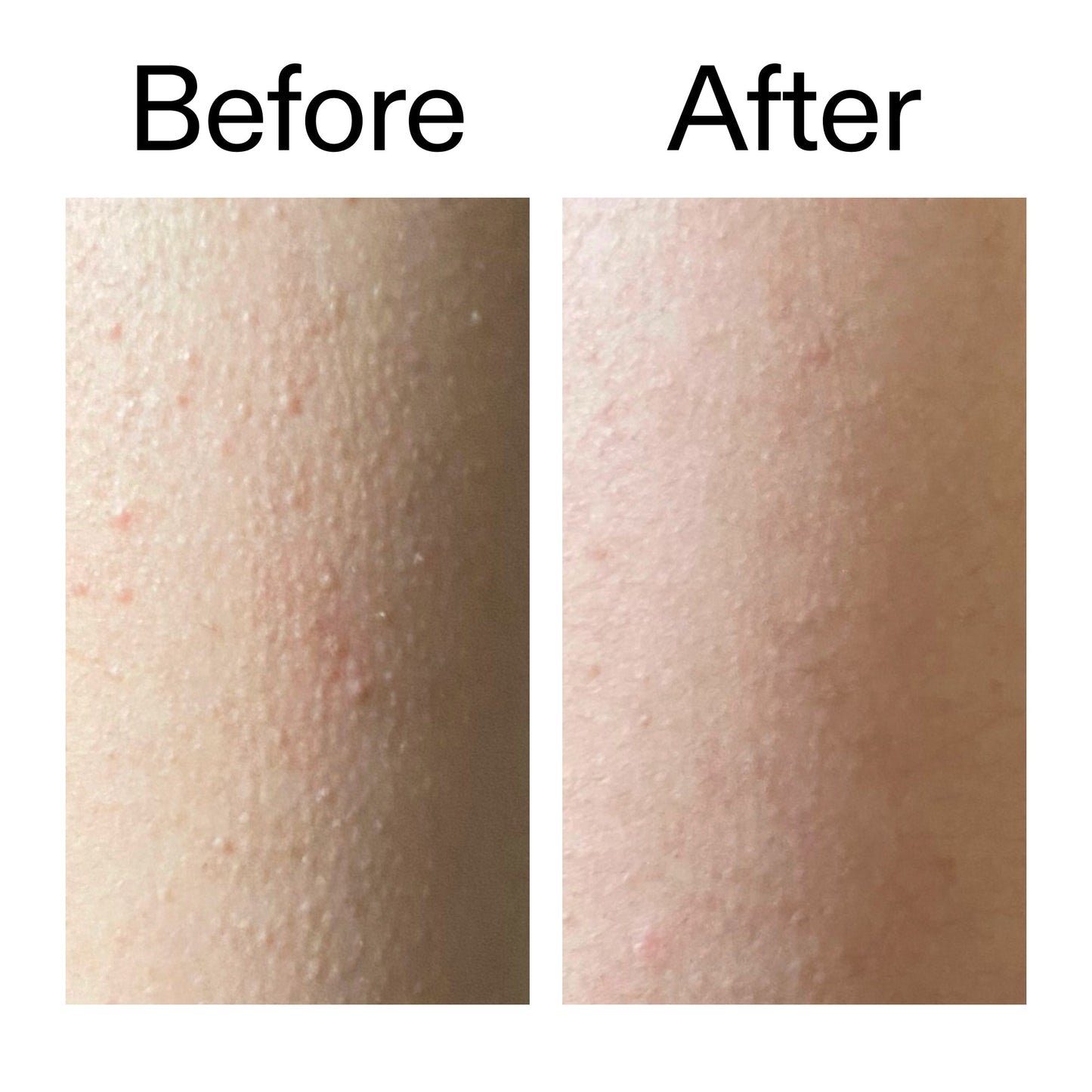 glycolic-acid-exfoliating-body-stick-j7 Glycolic_Acid_Exfoliating_Body_Stick_Before_After_V2_2000x2000_2e4ba052-94f6-4d56-82df-7bdb5b2df7ae.jpg