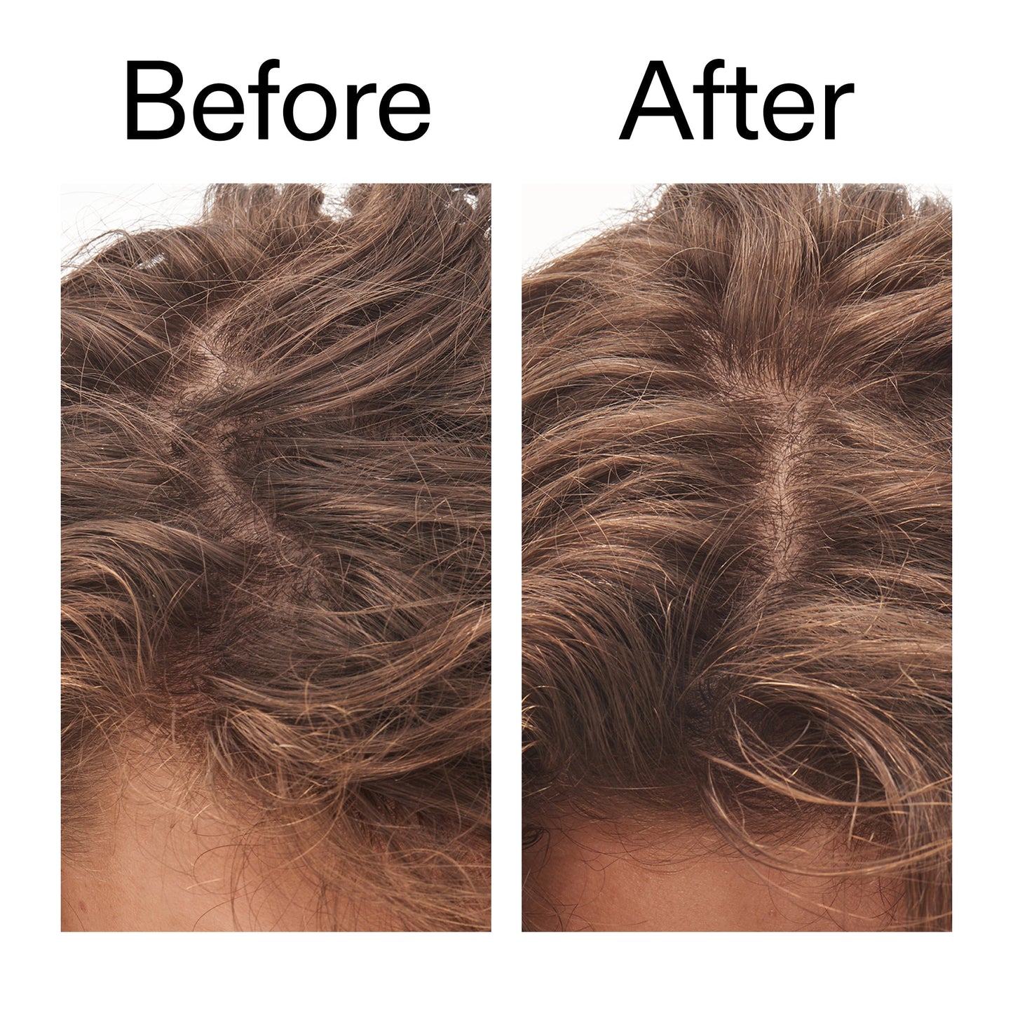glycolic-acid-exfoliating-scalp-scrub-c8 Glycolic_Acid_Exfoliating_Scalp_Scrub_Before_After_2000x2000_b8561c87-05a1-4caa-80f7-1b6b33d750f7.jpg