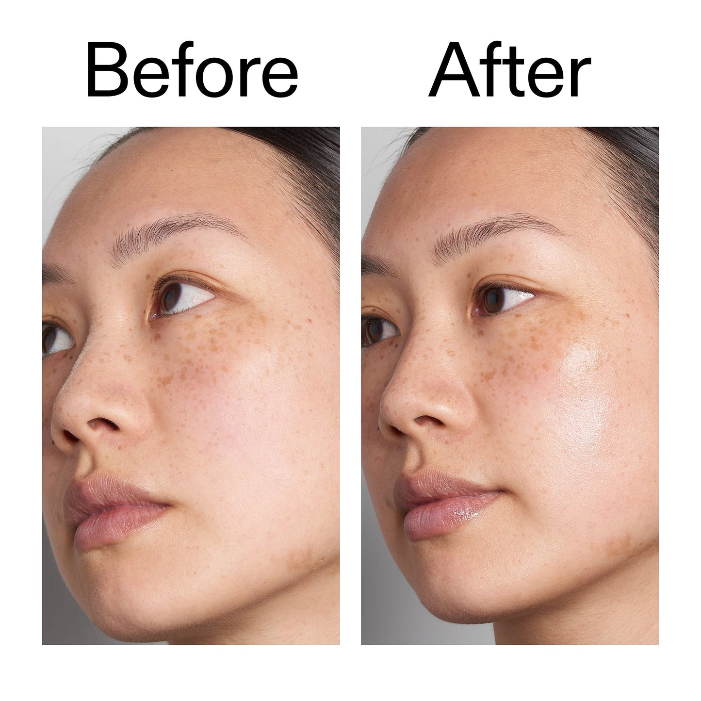 supersize-hyaluronic-acid-serum-100ml-f0 Hyaluronic_Acid_Before_After_2000x2000_d7983956-8aa2-4ea3-8255-c63e8d4f892e.jpg