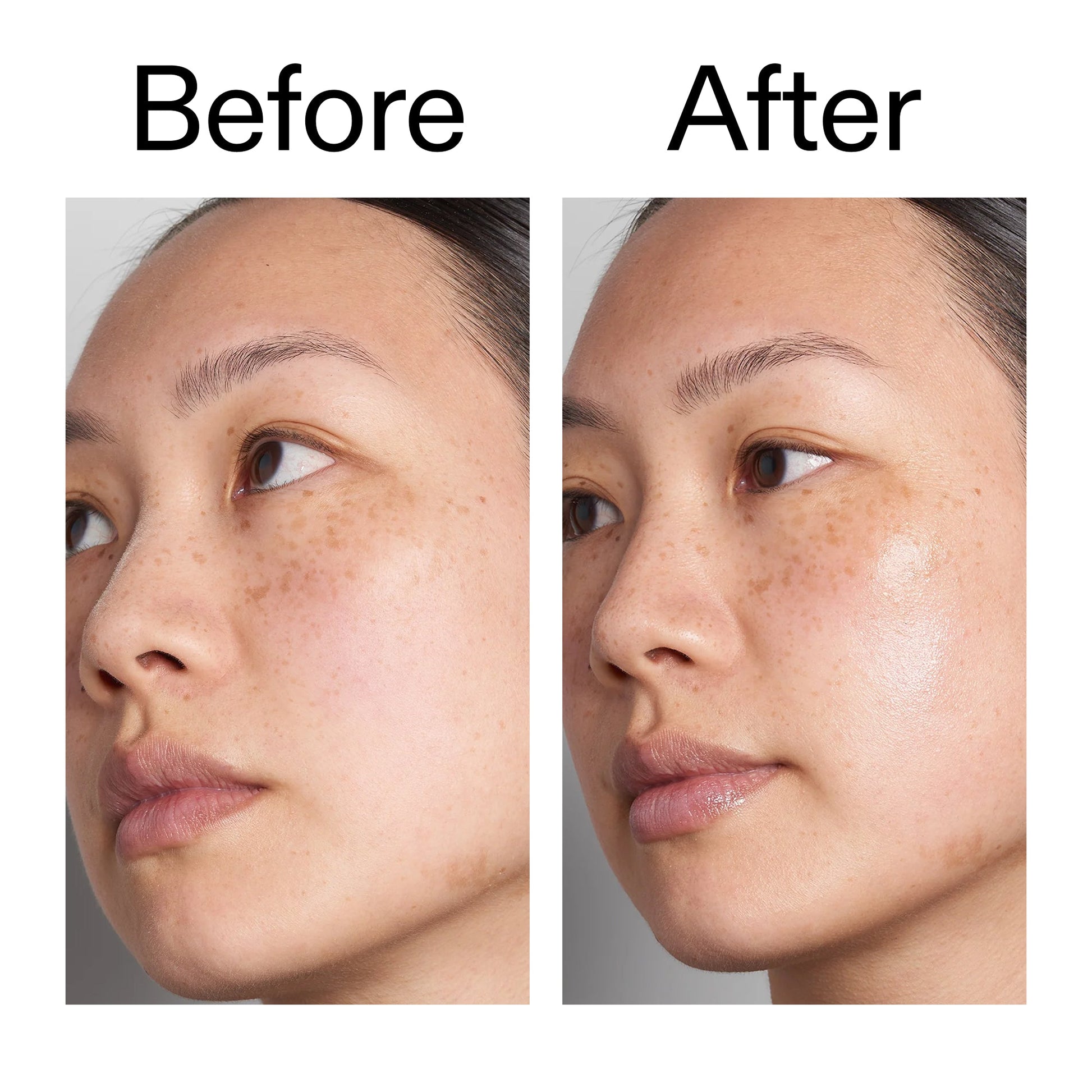 supersize-hyaluronic-acid-serum-100ml-duo-i1 Hyaluronic_Acid_Before_After_2000x2000_d7983956-8aa2-4ea3-8255-c63e8d4f892e.jpg