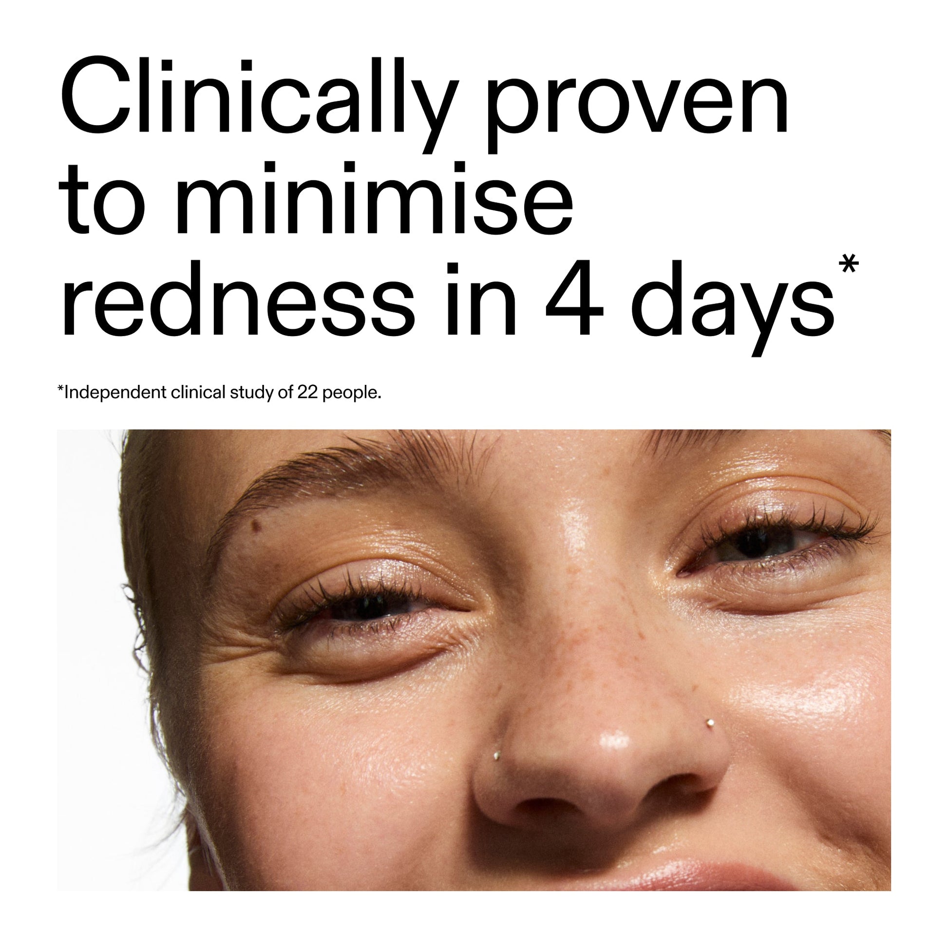 10-azelaic-acid-serum-for-redness-relief-l7 Oat_Cleansing_Balm_Claim_2000x2000_52a841dc-353c-4f2c-8646-3aadb604507d.jpg