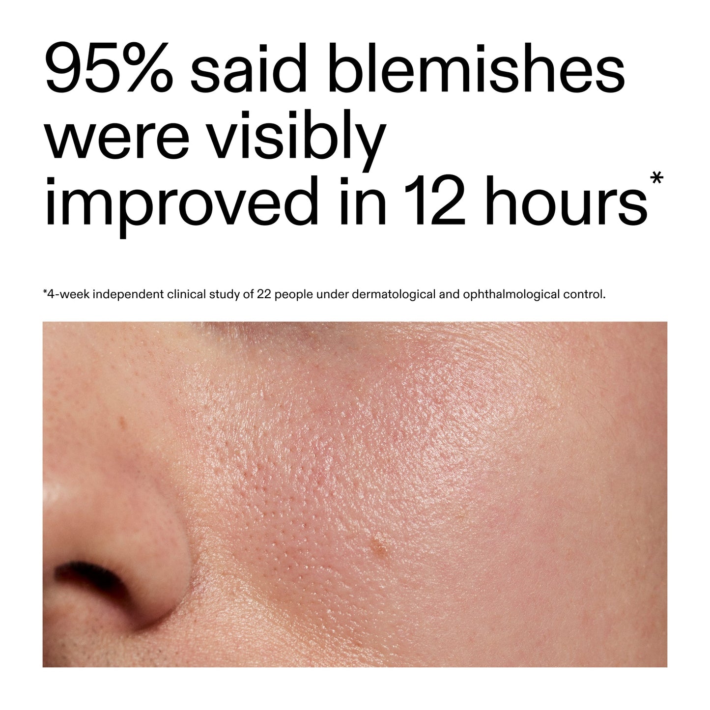 succinic-acid-acne-treatment-y0 Oat_Cleansing_Balm_Claim_2000x2000_ac6ce553-25db-41b2-a981-faae1ac4b8c0.jpg