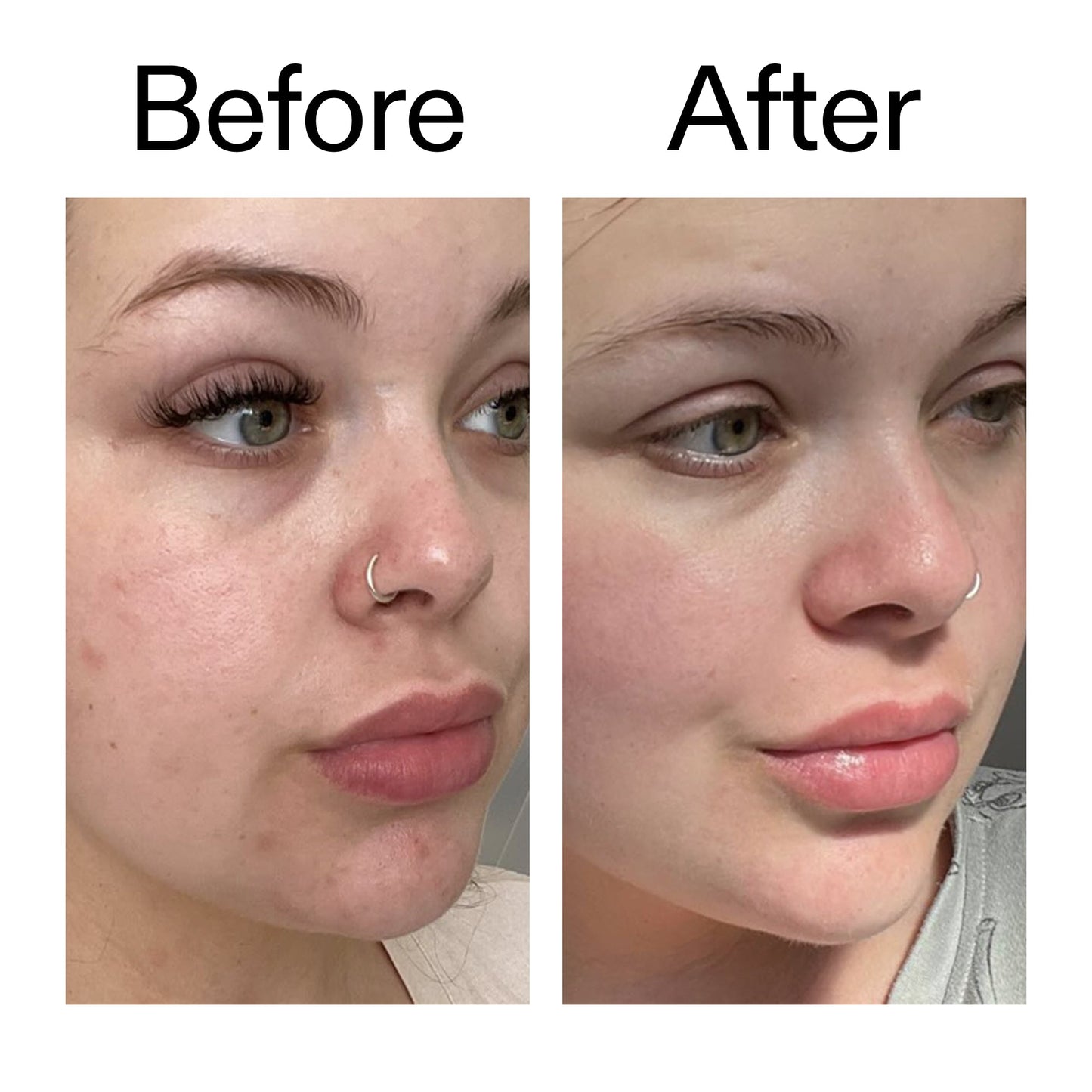 supersize-omega-water-cream-duo-s8 Omega50_Before_After_2000x2000_46483ed8-3f9d-487f-9a0c-9df79830bd65.jpg