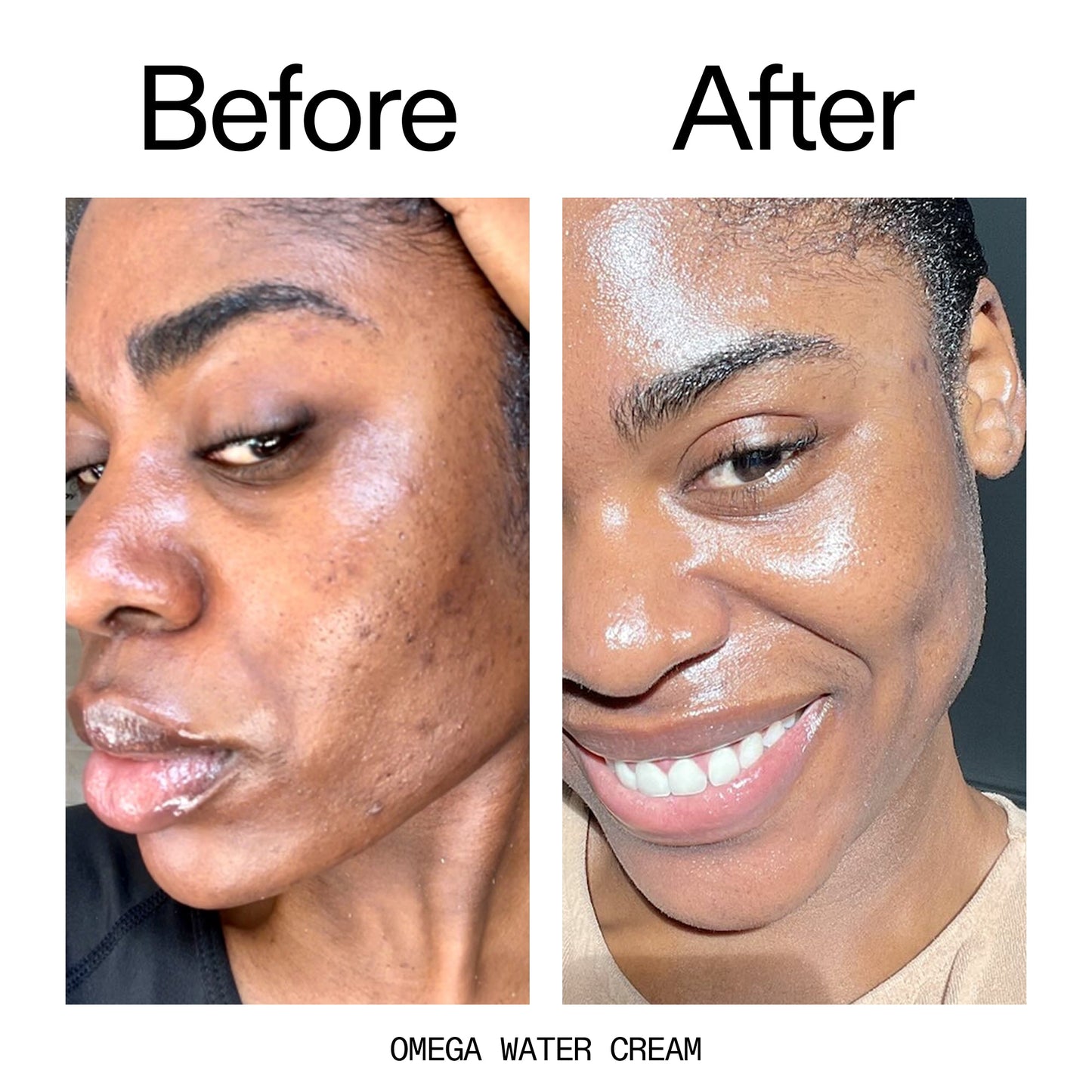 hydrating-cleanser-and-moisturizer-duo-j4 Omega_Water_Cream_Before_After_2000x2000_8e88278b-8c8d-48dc-ac77-4e98ebbd1b77.jpg