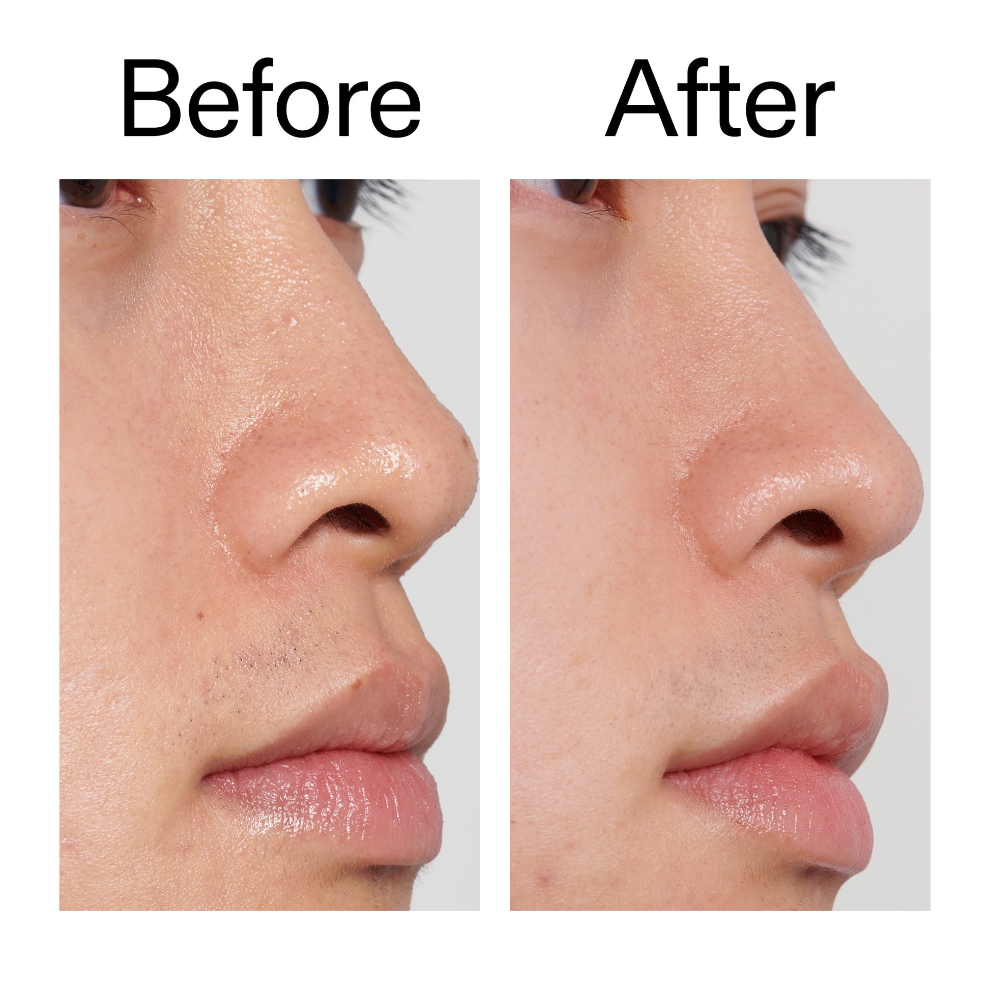 pha-toner-l0 PHA_Toner_Before_After_2000x2000_e3c10172-0150-4342-8b95-57417eaff50d.jpg