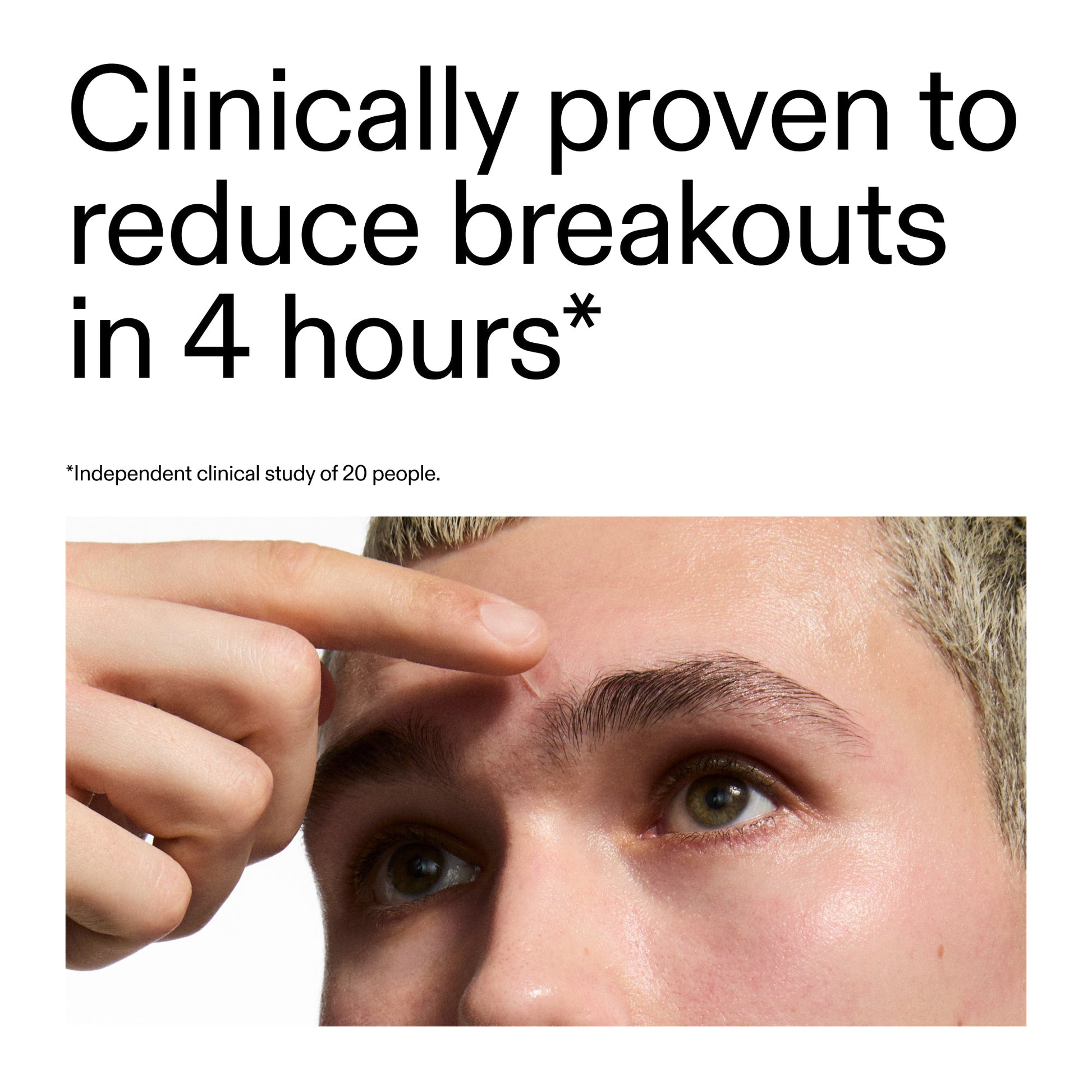 hydrocolloid-invisible-pimple-patches-pack-of-44-a7 ROW_Hydrocolloid_Invisible_Pimple_Patches_key_Claims_2000x2000_502d17b0-f9be-42e0-81ed-9ccfa57cfe05.jpg