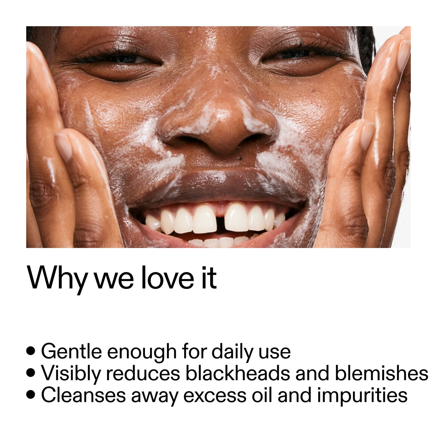 salicylic-acid-cleanser-150ml-d7 Salicylic_Acid_Cleanser_-_300mlWhy_we_love_it_2000x2000_87dc92a9-2559-4309-98cd-4e570f1be735.jpg