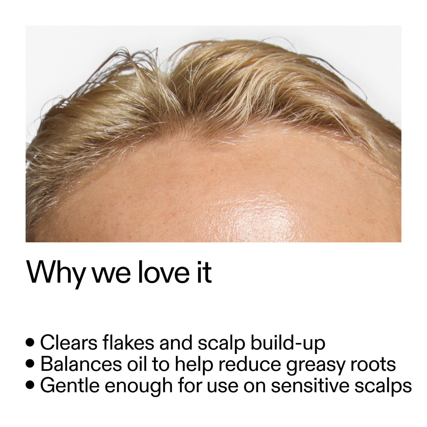 salicylic-acid-exfoliating-scalp-treatment-f2 Salicylic_Acid_Exfoliating_Scalp_Treatment_Why_we_love_it_2000x2000_44b6bd6d-9ec4-4b23-9dc4-bc3fd6f28e14.jpg