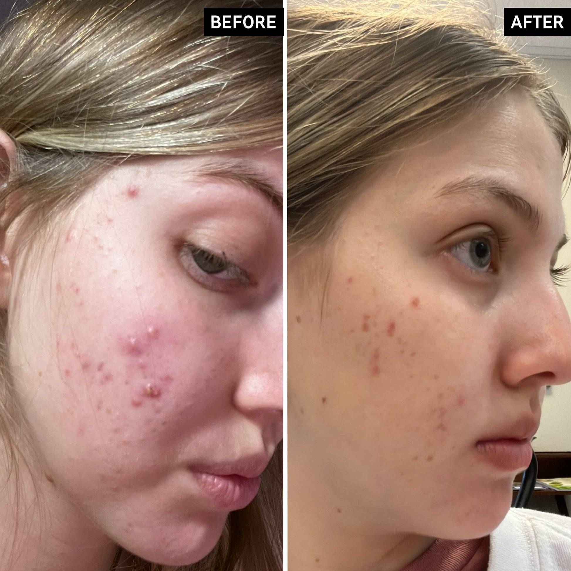 salicylic-acid-cleanser-duo-w2 SamanthaB_A_2000x2000_54062586-cec1-44d9-a20a-bda2c4f03f5f.jpg