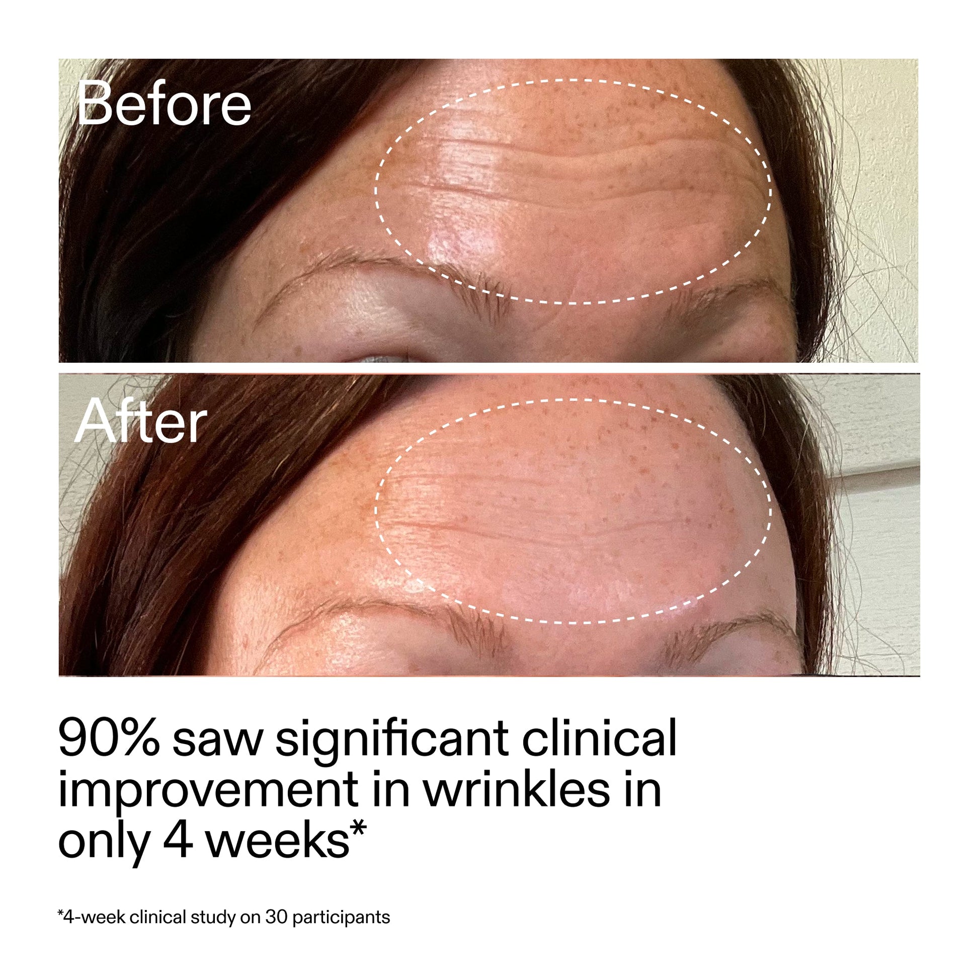 starter-retinol-serum-f4 StarterRetinol_BeforeAfter_Claim1_2000x2000_a09b50b6-4688-4527-abae-21bd142b89b7.jpg