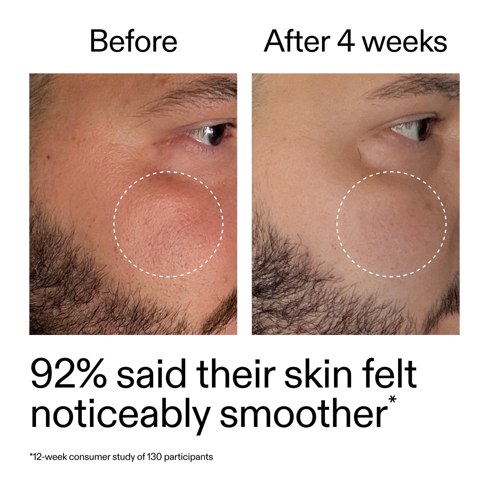 starter-retinol-serum-f4 StarterRetinol_BeforeAfter_Claim3_2000x2000_6ceab106-e0ee-4ed4-ba62-41bc39538038.jpg