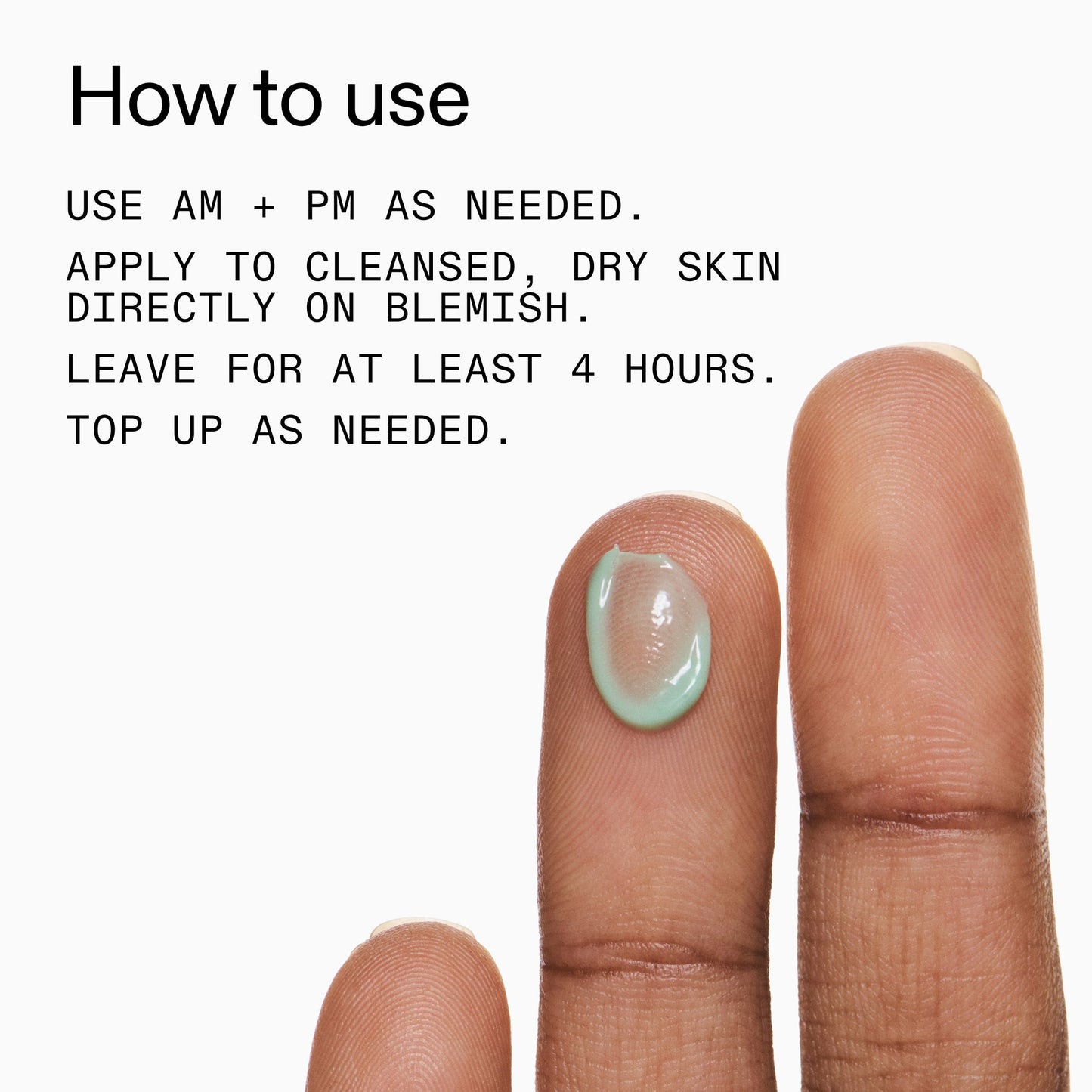 succinic-acid-acne-treatment-y0 Succinic_Acid_Treatment_How_to_Use_2000x2000_d57137d5-d7f1-427c-9a46-5fc00c19c542.jpg