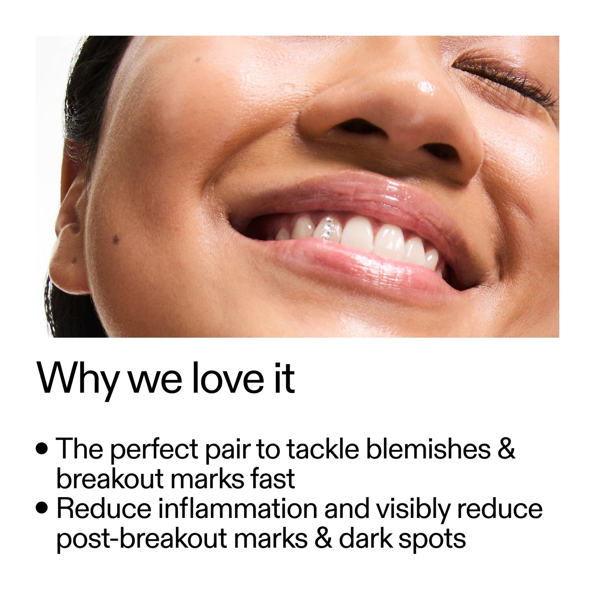 targeted-blemish-duo-h8 Targeted_Blemish_Duo_Why_we_love_it_2000x2000_ff00be46-438b-485f-b5c3-91e60bbb6919.jpg