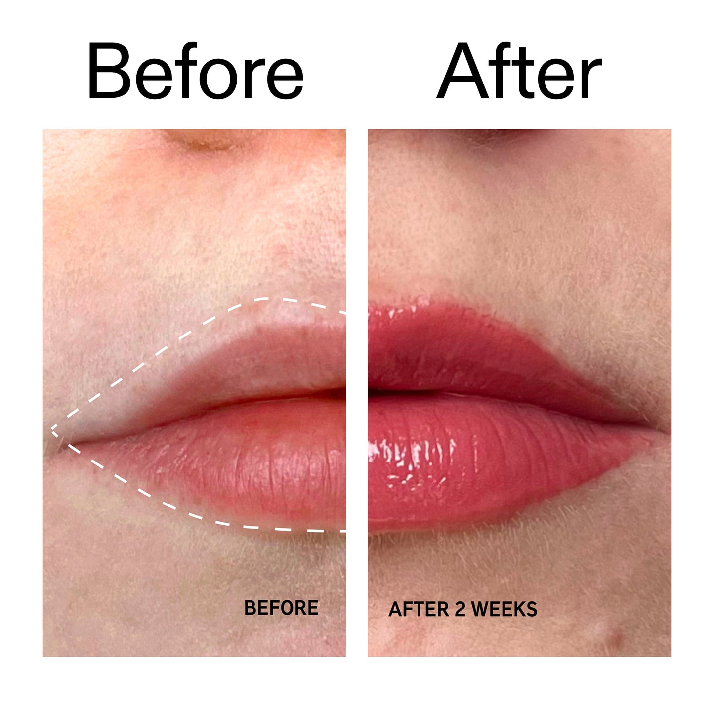 tripeptide-plumping-berry-lip-balm-l8 Tripeptide_Plumping_Lip_Balm_-_Berry_Before_After_2000x2000_9474bbd8-43ca-4b0e-b0e7-dfab70b91927.jpg