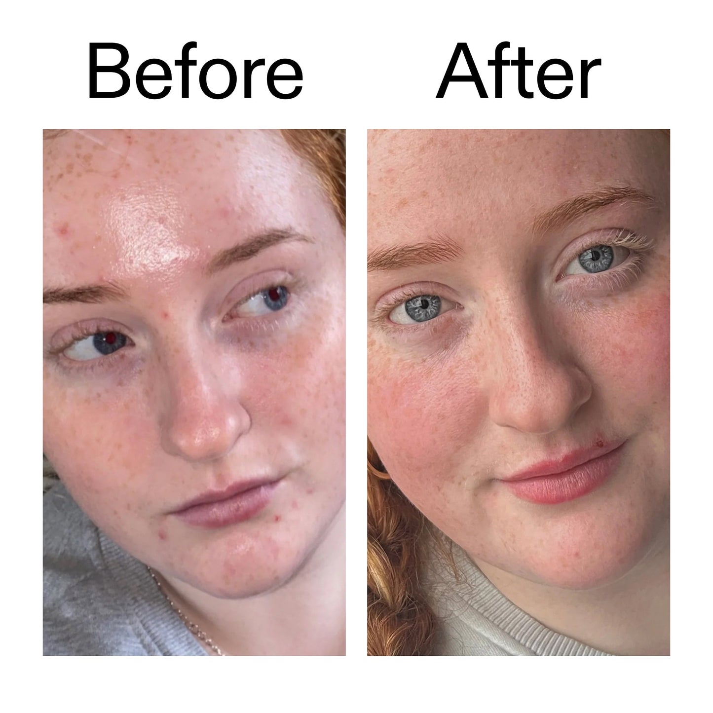 vitamin-b-c-and-e-moisturizer-u4 Vitamin_B_C_and_E_Moisturizer_Before_After_2000x2000_b0781a76-5ad2-4be9-95b8-ef92b356833c.jpg